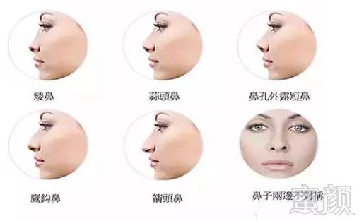https://img.miyanlife.com/mnt/timg/180907/115922L55-3.jpg