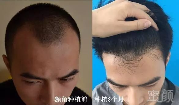 https://img.miyanlife.com/mnt/timg/180907/12110G021-8.jpg