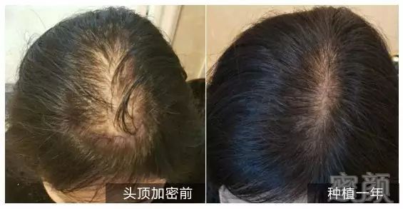 https://img.miyanlife.com/mnt/timg/180907/12110I194-10.jpg