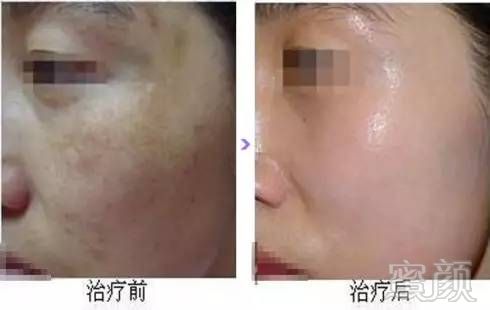 https://img.miyanlife.com/mnt/timg/180907/1216262548-7.jpg