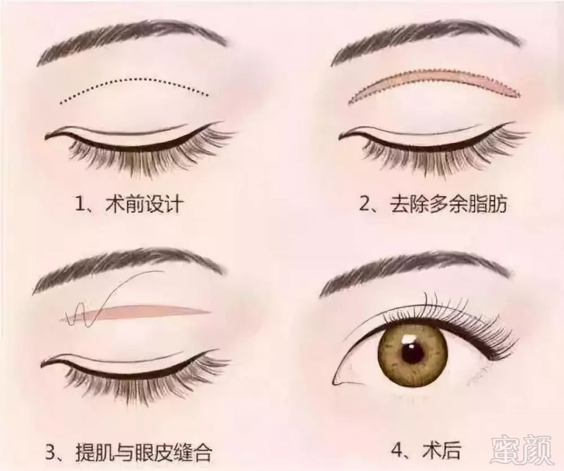 https://img.miyanlife.com/mnt/timg/180907/1220545129-10.jpg