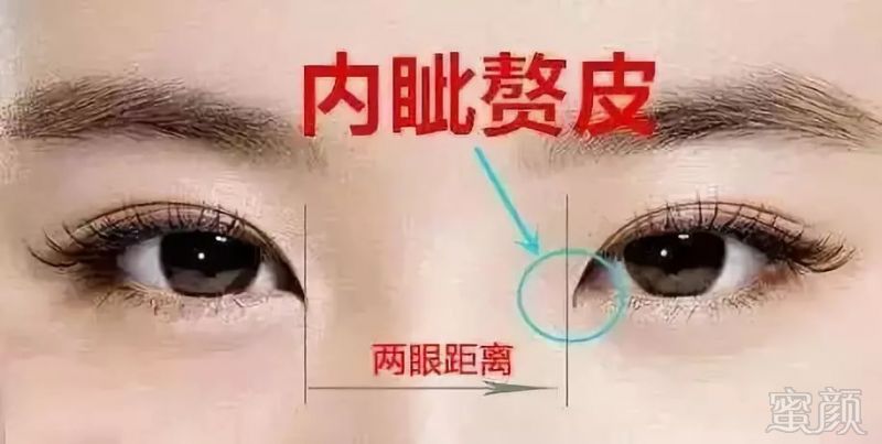 https://img.miyanlife.com/mnt/timg/180907/1230231225-1.jpg