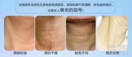 https://img.miyanlife.com/mnt/timg/180907/1230563941-0.jpg