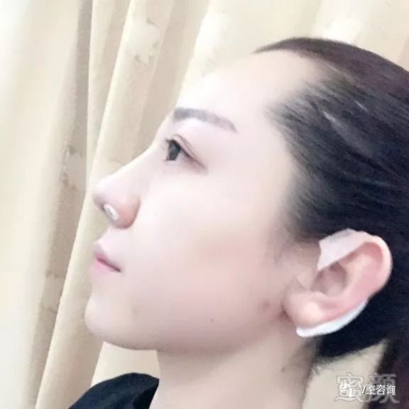 https://img.miyanlife.com/mnt/timg/180907/12313442a-1.jpg