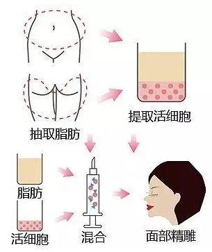 https://img.miyanlife.com/mnt/timg/180907/123224JY-12.jpg