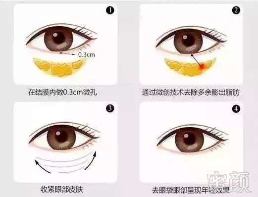 https://img.miyanlife.com/mnt/timg/180907/12494S1W-8.jpg