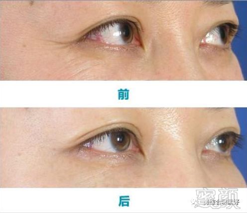https://img.miyanlife.com/mnt/timg/180907/1303223Y2-2.jpg