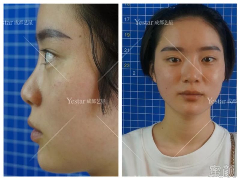 https://img.miyanlife.com/mnt/timg/180907/130T33345-1.jpg
