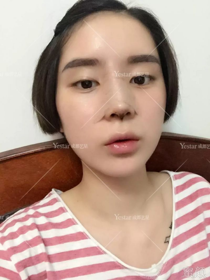 https://img.miyanlife.com/mnt/timg/180907/130T4D04-6.jpg
