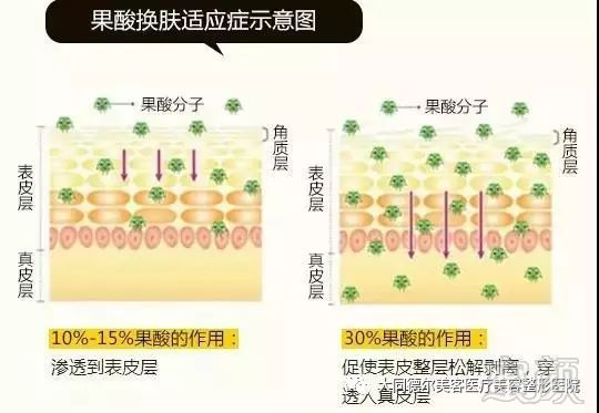 案例图片