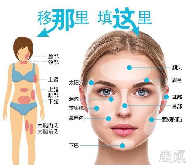 https://img.miyanlife.com/mnt/timg/180908/1139452F3-1.jpg