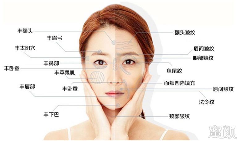https://img.miyanlife.com/mnt/timg/180908/11394542L-2.jpg