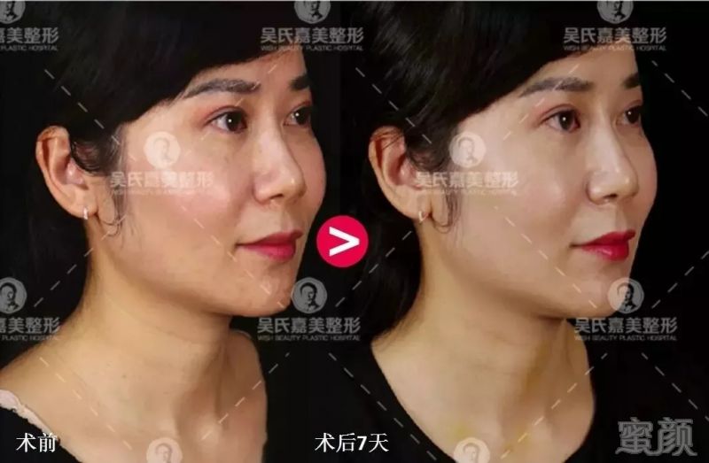 https://img.miyanlife.com/mnt/timg/180908/1155291417-4.jpg