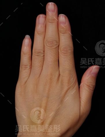 https://img.miyanlife.com/mnt/timg/180908/11552942Y-2.jpg