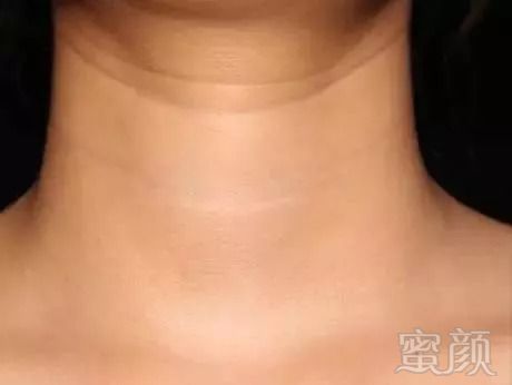 https://img.miyanlife.com/mnt/timg/180908/121235DU-0.jpg