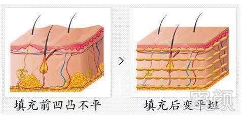 案例图片