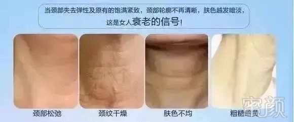 https://img.miyanlife.com/mnt/timg/180908/1223502593-2.jpg