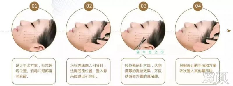 https://img.miyanlife.com/mnt/timg/180908/12235034L-4.jpg