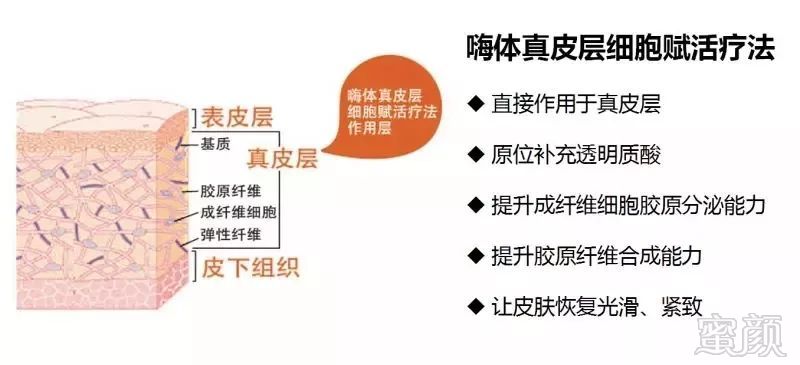 https://img.miyanlife.com/mnt/timg/180908/122444E45-7.jpg