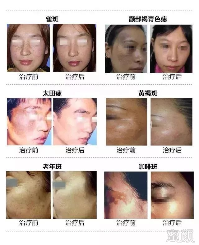 https://img.miyanlife.com/mnt/timg/180908/122F31Q9-2.jpg