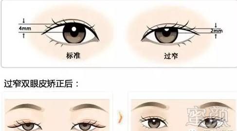 https://img.miyanlife.com/mnt/timg/180908/122I622T-0.jpg