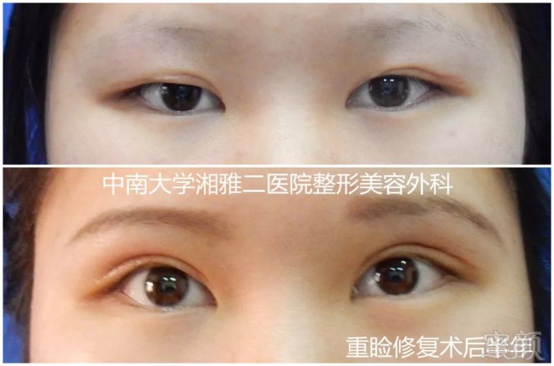 https://img.miyanlife.com/mnt/timg/180908/122IC003-2.jpg