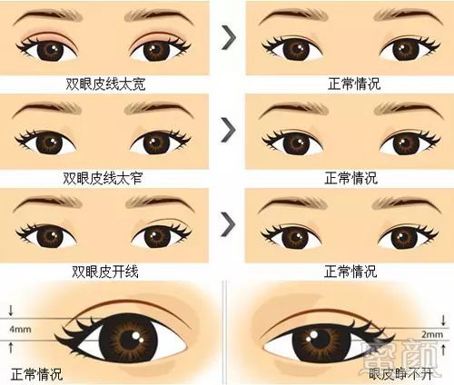 https://img.miyanlife.com/mnt/timg/180908/122IC593-1.jpg