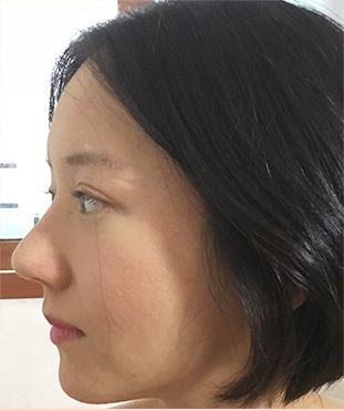https://img.miyanlife.com/mnt/timg/180908/12443220C-2.jpg