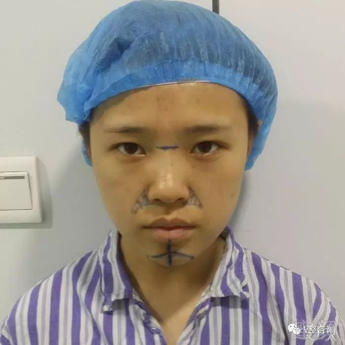 https://img.miyanlife.com/mnt/timg/180908/1245263620-1.jpg
