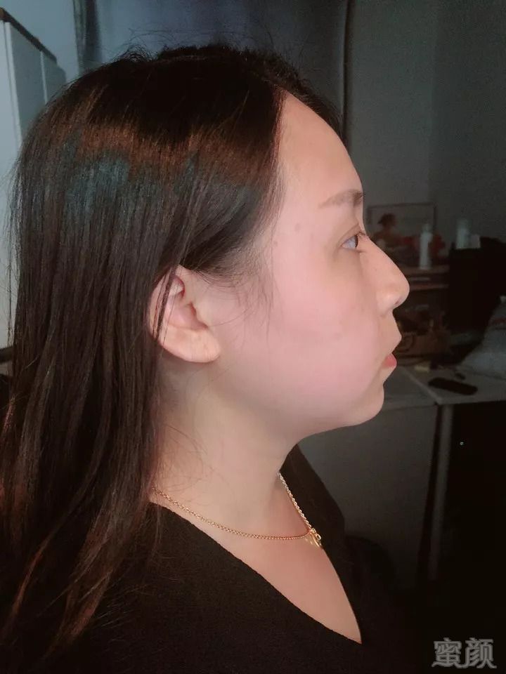 https://img.miyanlife.com/mnt/timg/180908/1253094Q3-1.jpg