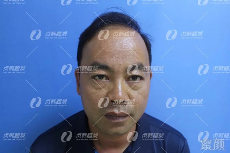 https://img.miyanlife.com/mnt/timg/180908/13012Q5S-0.jpg