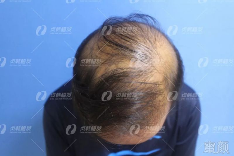 https://img.miyanlife.com/mnt/timg/180908/13012Qb5-1.jpg