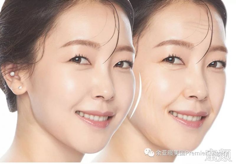 https://img.miyanlife.com/mnt/timg/180908/13222S3G-2.jpg