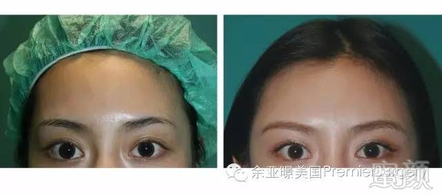https://img.miyanlife.com/mnt/timg/180908/13222S640-5.jpg