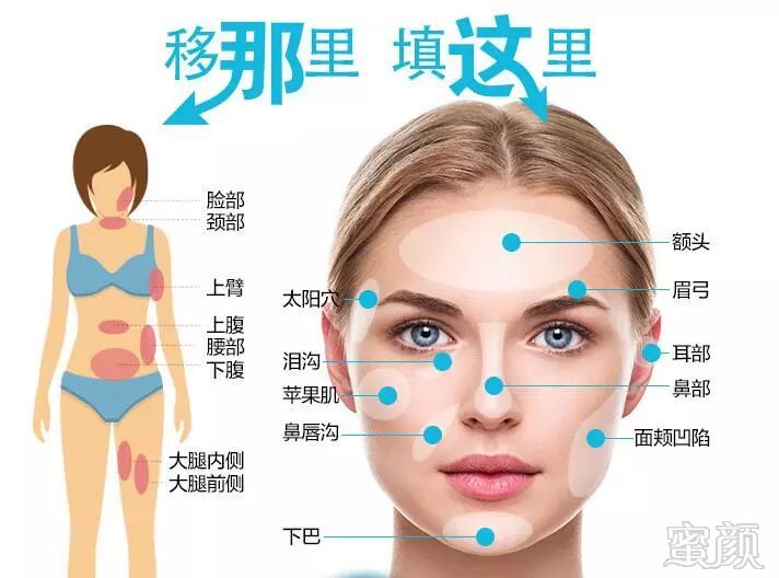 https://img.miyanlife.com/mnt/timg/180908/13222UD5-3.jpg