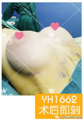 https://img.miyanlife.com/mnt/timg/180908/1414135B8-2.jpg