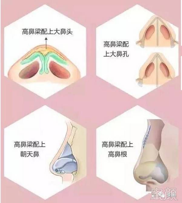 https://img.miyanlife.com/mnt/timg/180908/1439311T2-1.jpg