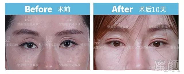 https://img.miyanlife.com/mnt/timg/180909/102921M57-1.jpg