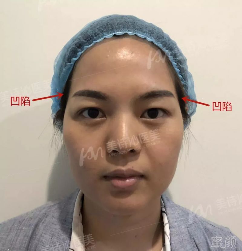 https://img.miyanlife.com/mnt/timg/180909/10320941H-3.jpg