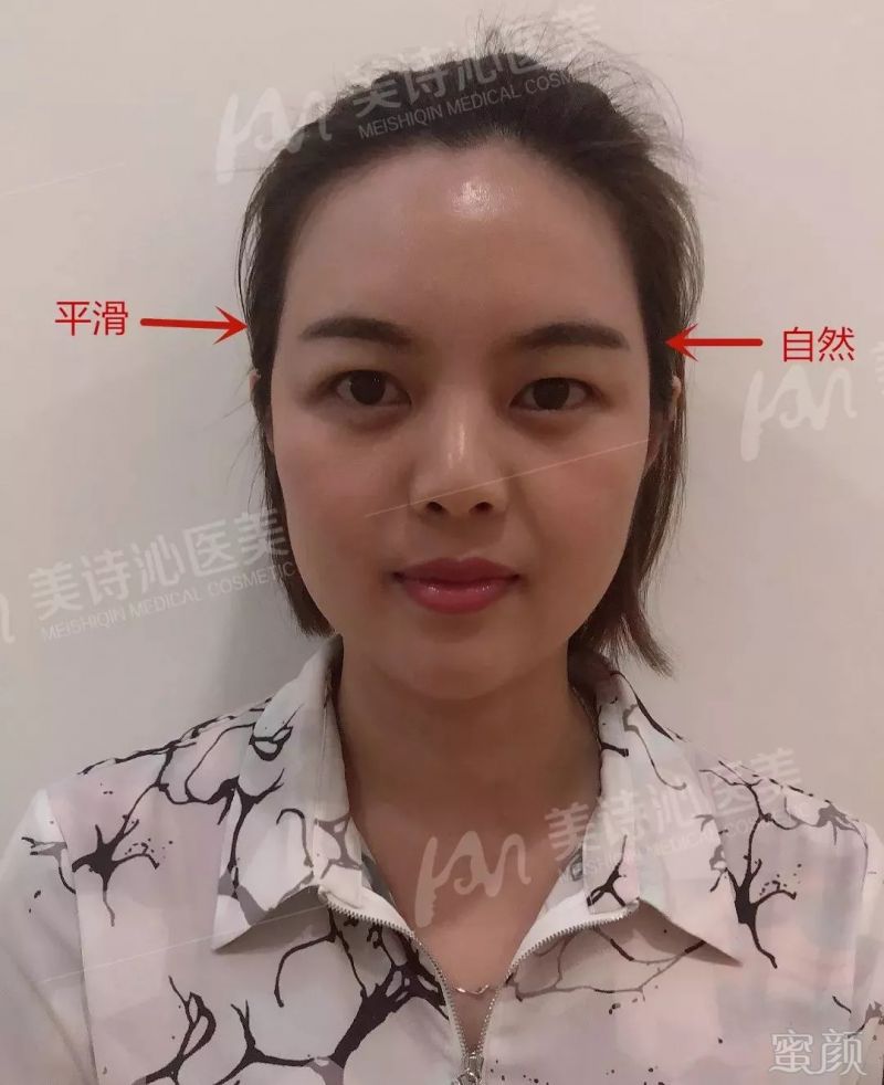 https://img.miyanlife.com/mnt/timg/180909/10321022K-4.jpg