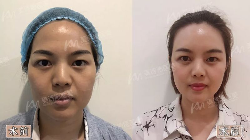 https://img.miyanlife.com/mnt/timg/180909/1032106362-5.jpg