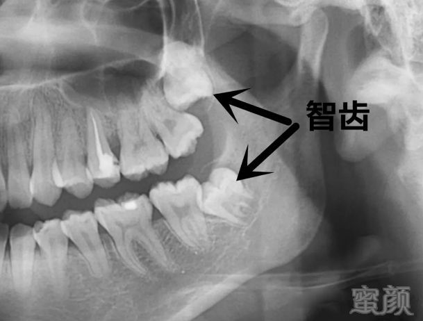 案例图片