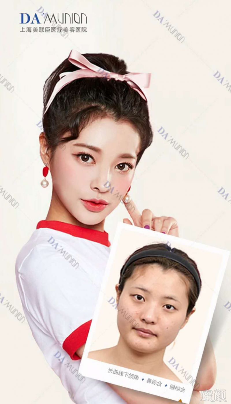 https://img.miyanlife.com/mnt/timg/180909/10443Q046-5.jpg