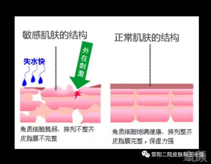 案例图片