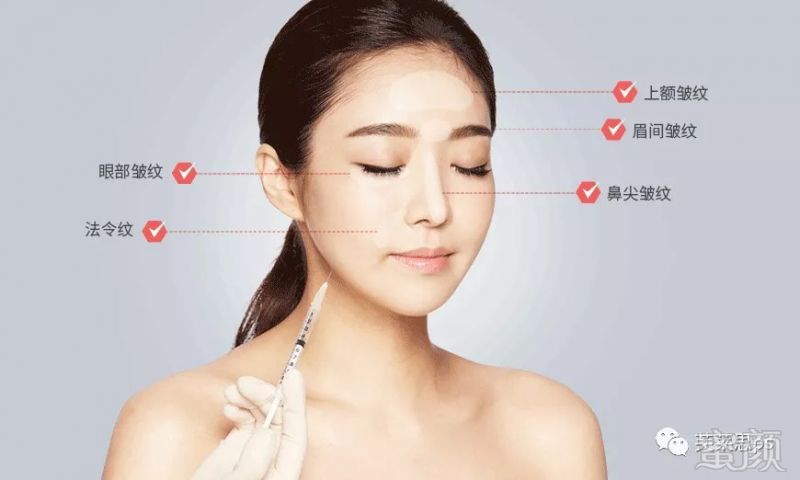 https://img.miyanlife.com/mnt/timg/180909/1103262537-0.jpg