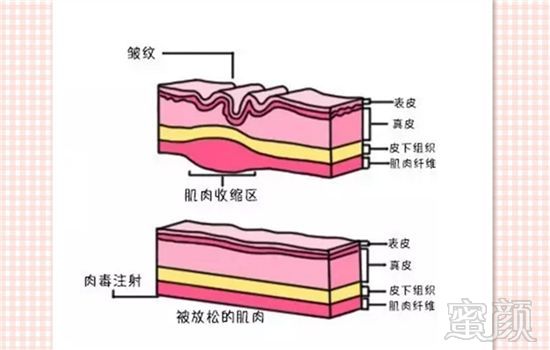 https://img.miyanlife.com/mnt/timg/180909/11032H311-6.jpg