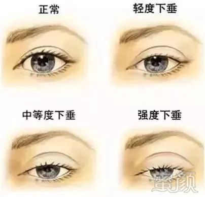 https://img.miyanlife.com/mnt/timg/180909/11035V358-2.jpg