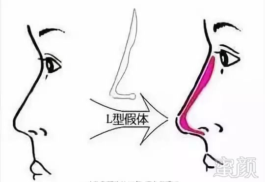 https://img.miyanlife.com/mnt/timg/180909/11120BM2-3.jpg