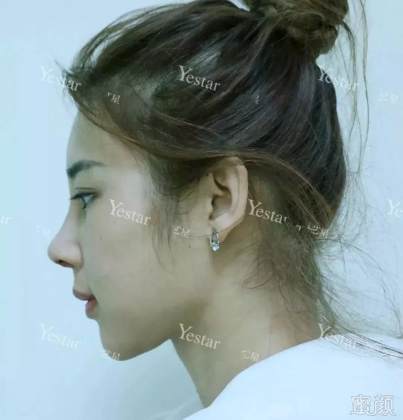 https://img.miyanlife.com/mnt/timg/180909/11120M133-8.jpg