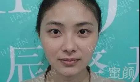 https://img.miyanlife.com/mnt/timg/180909/111G61Z7-1.jpg